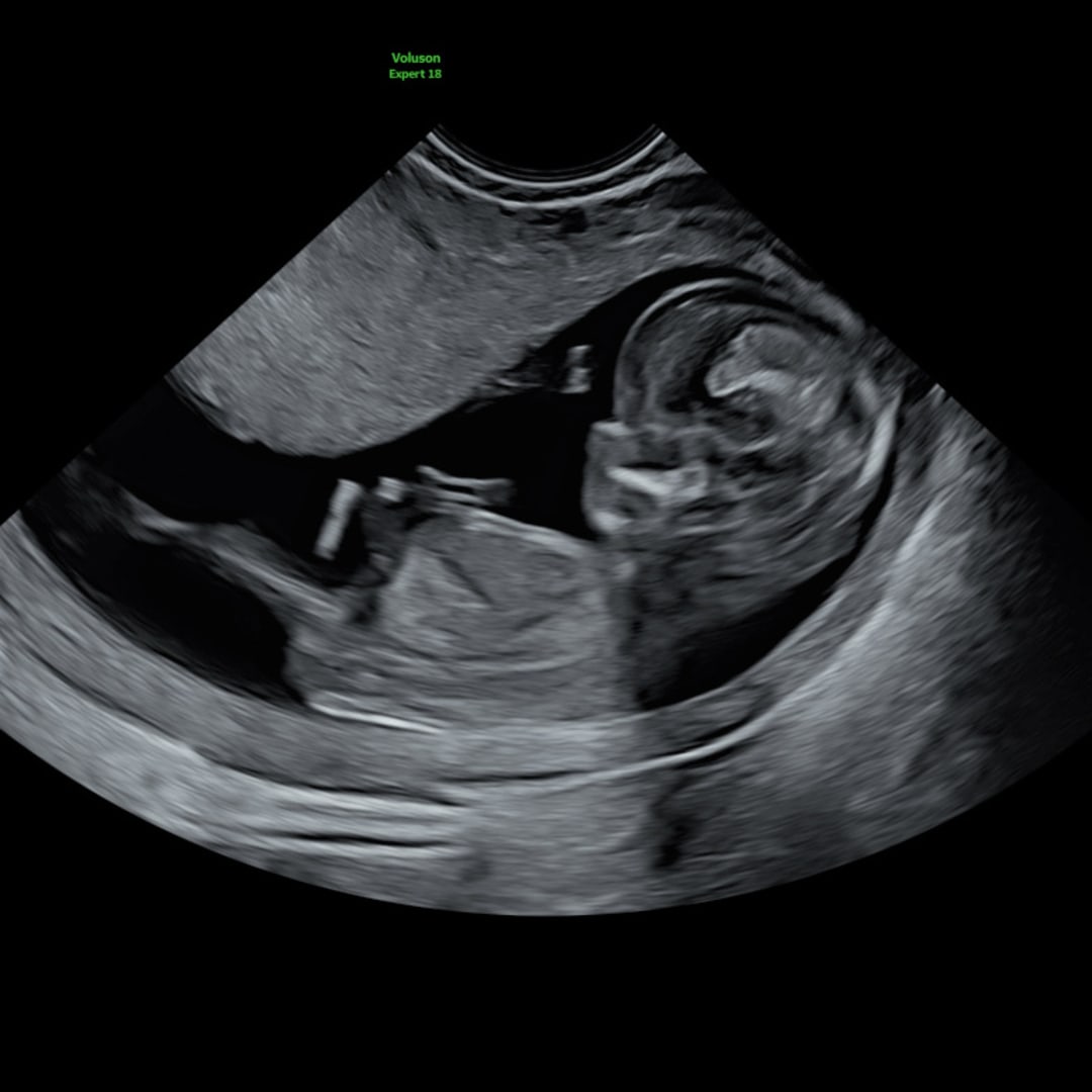 Photo shared by Jennifer for their Babylist baby registry.