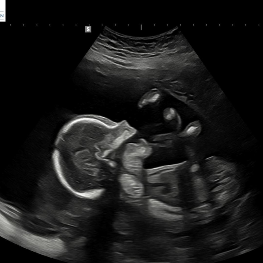 Photo shared by Jordan for their Babylist baby registry.