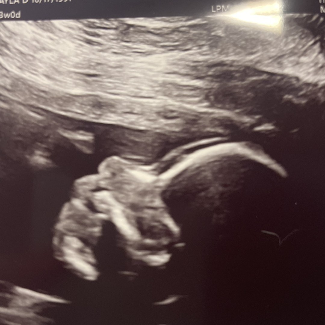 Photo shared by Makayla for their Babylist baby registry.