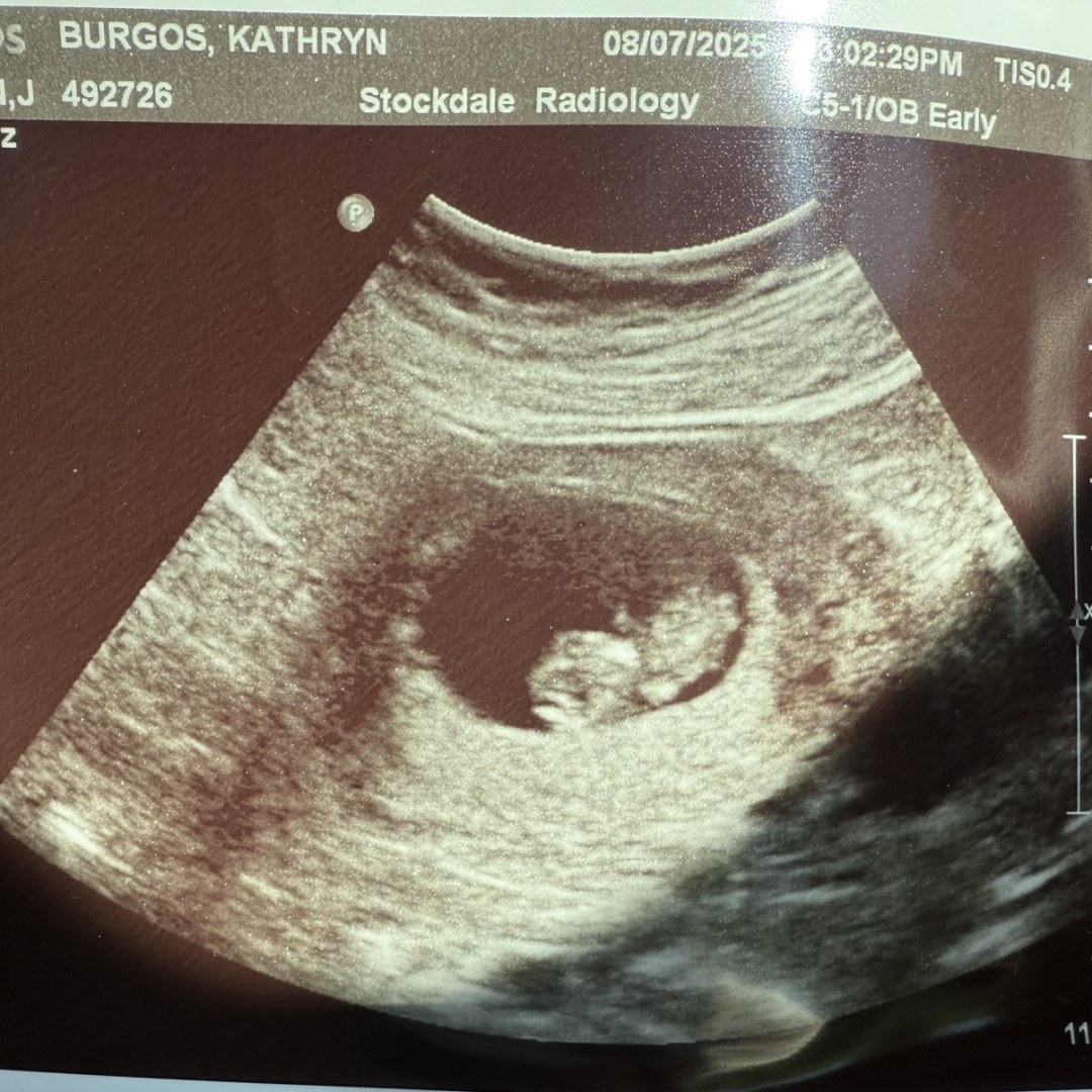 Photo shared by Kathryn for their Babylist baby registry.