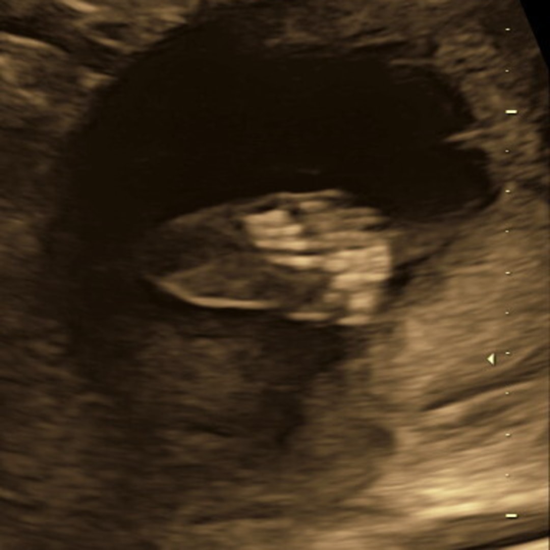 Photo shared by Laura for their Babylist baby registry.