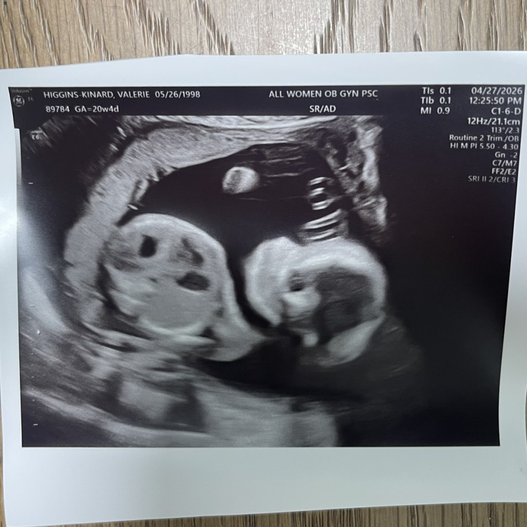 Photo shared by Valerie for their Babylist baby registry.