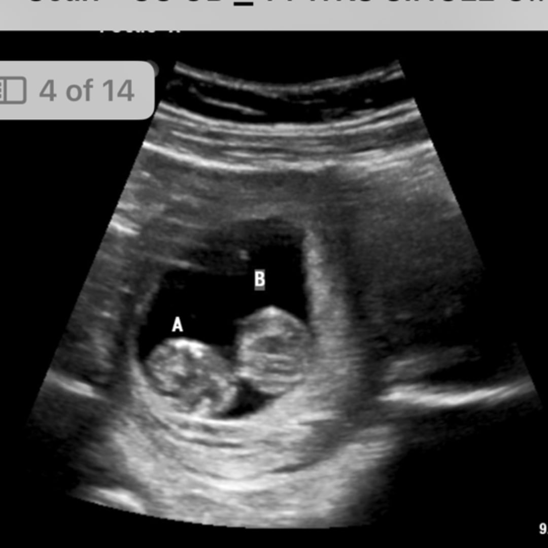 Photo shared by Ariadna for their Babylist baby registry.