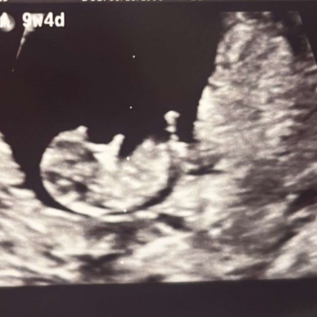 Photo shared by Ashley for their Babylist baby registry.