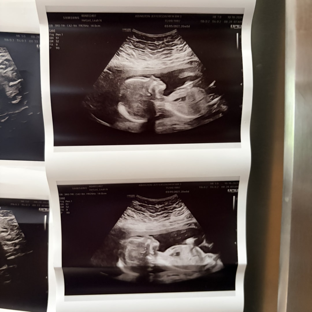 Photo shared by Leah for their Babylist baby registry.