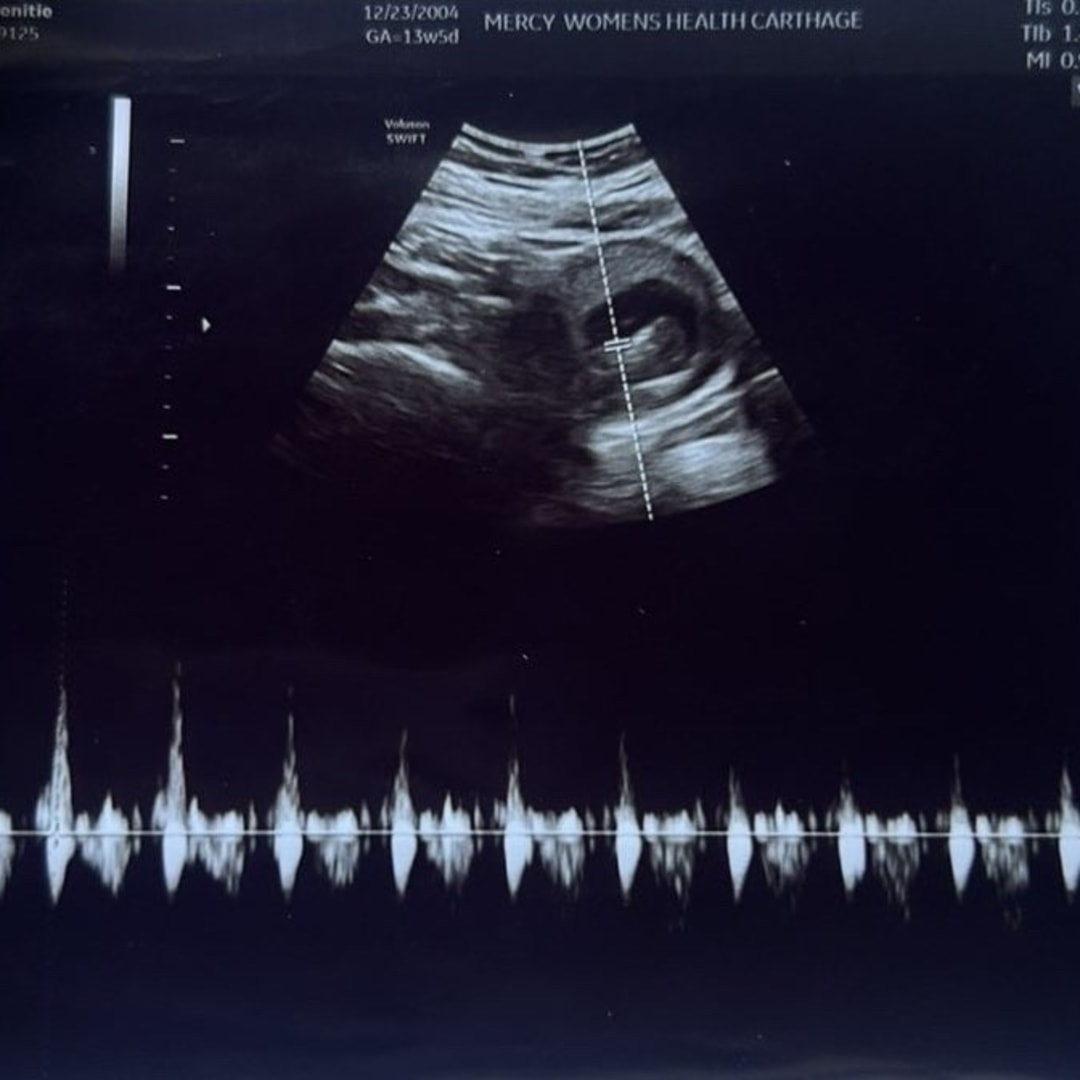 Photo shared by Trenitie for their Babylist baby registry.