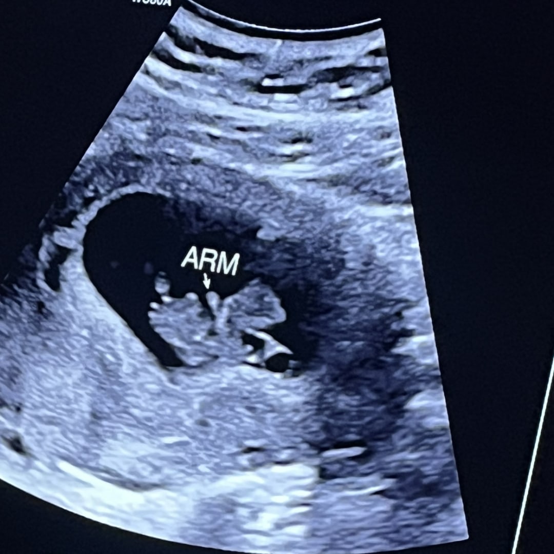 Photo shared by Erin for their Babylist baby registry.