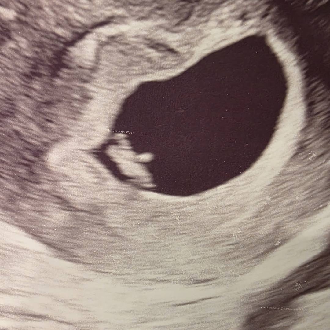 Photo shared by Chelsee for their Babylist baby registry.