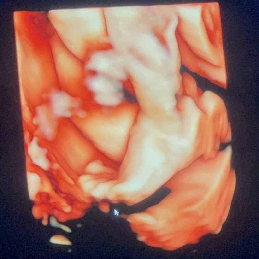 Photo shared by Kimberly for their Babylist baby registry.