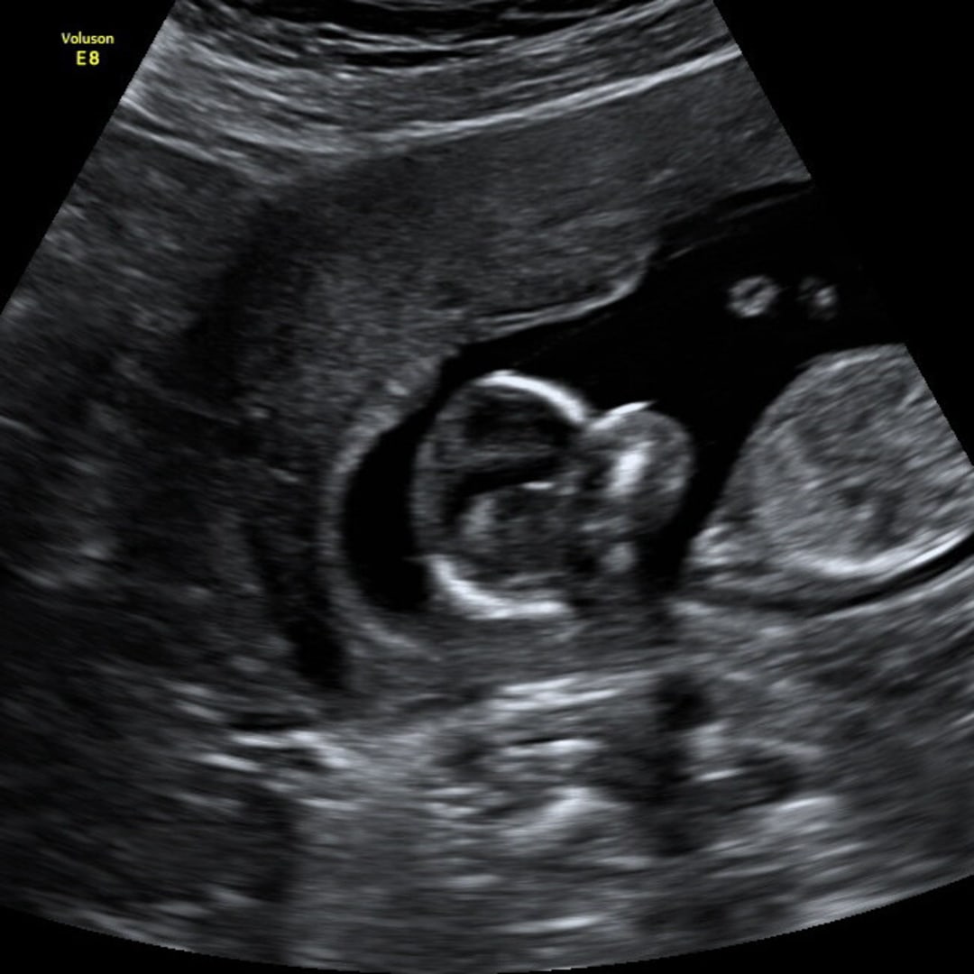 Photo shared by Chloe for their Babylist baby registry.