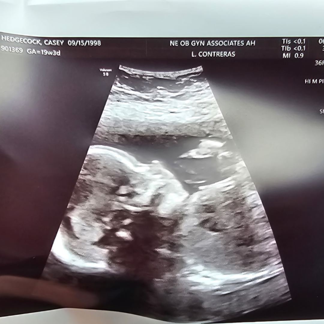 Photo shared by Casey for their Babylist baby registry.