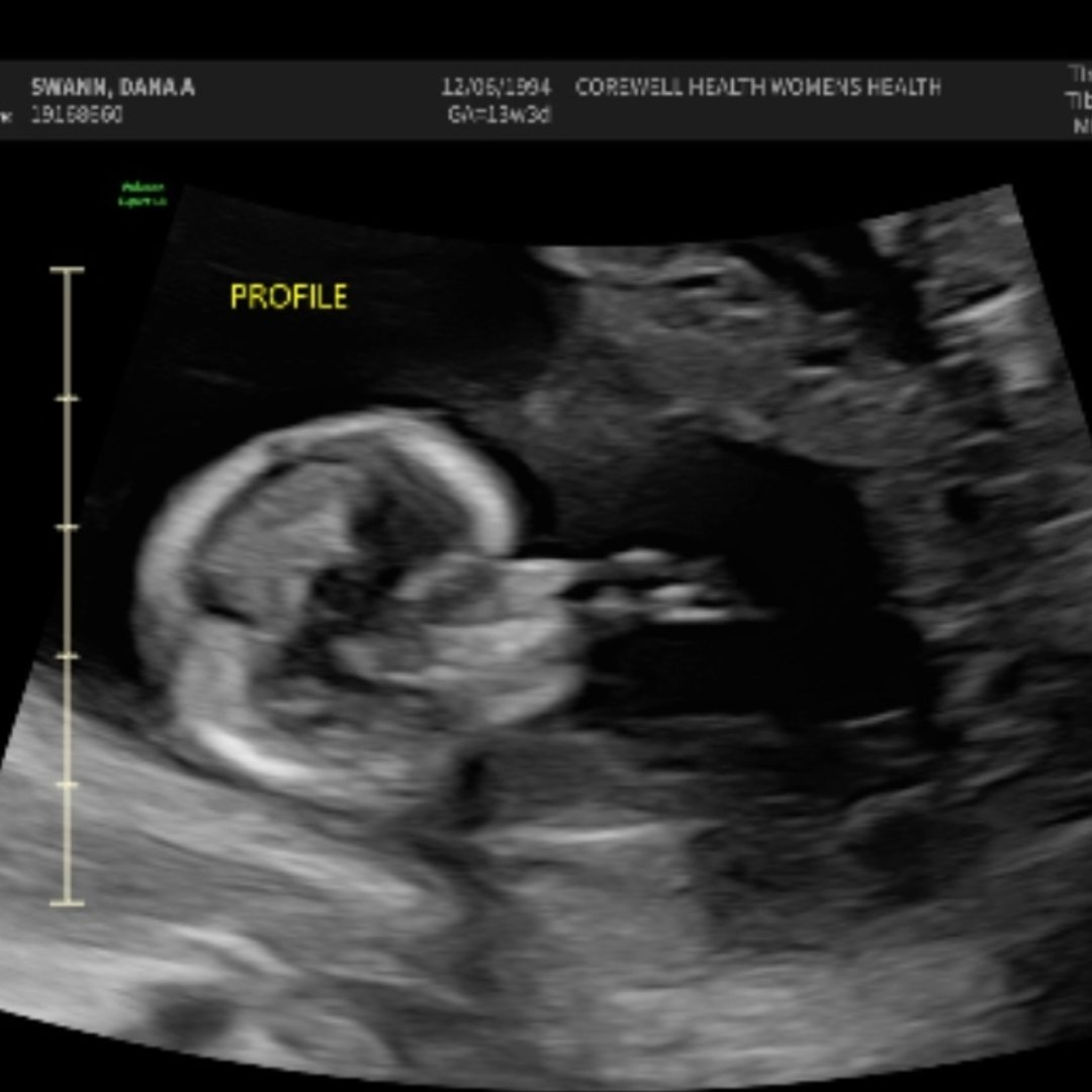Photo shared by Dana for their Babylist baby registry.