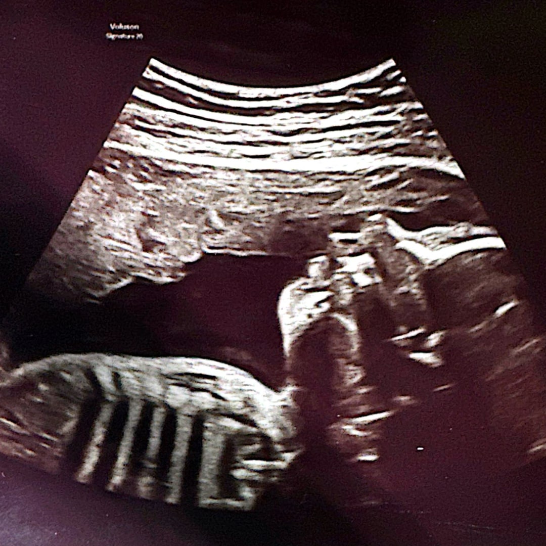 Photo shared by Sarah for their Babylist baby registry.
