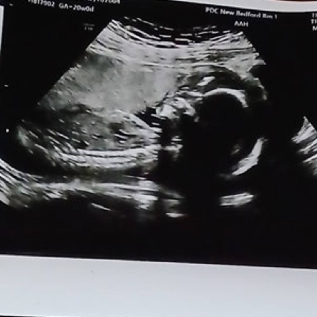 Photo shared by Ciarra for their Babylist baby registry.