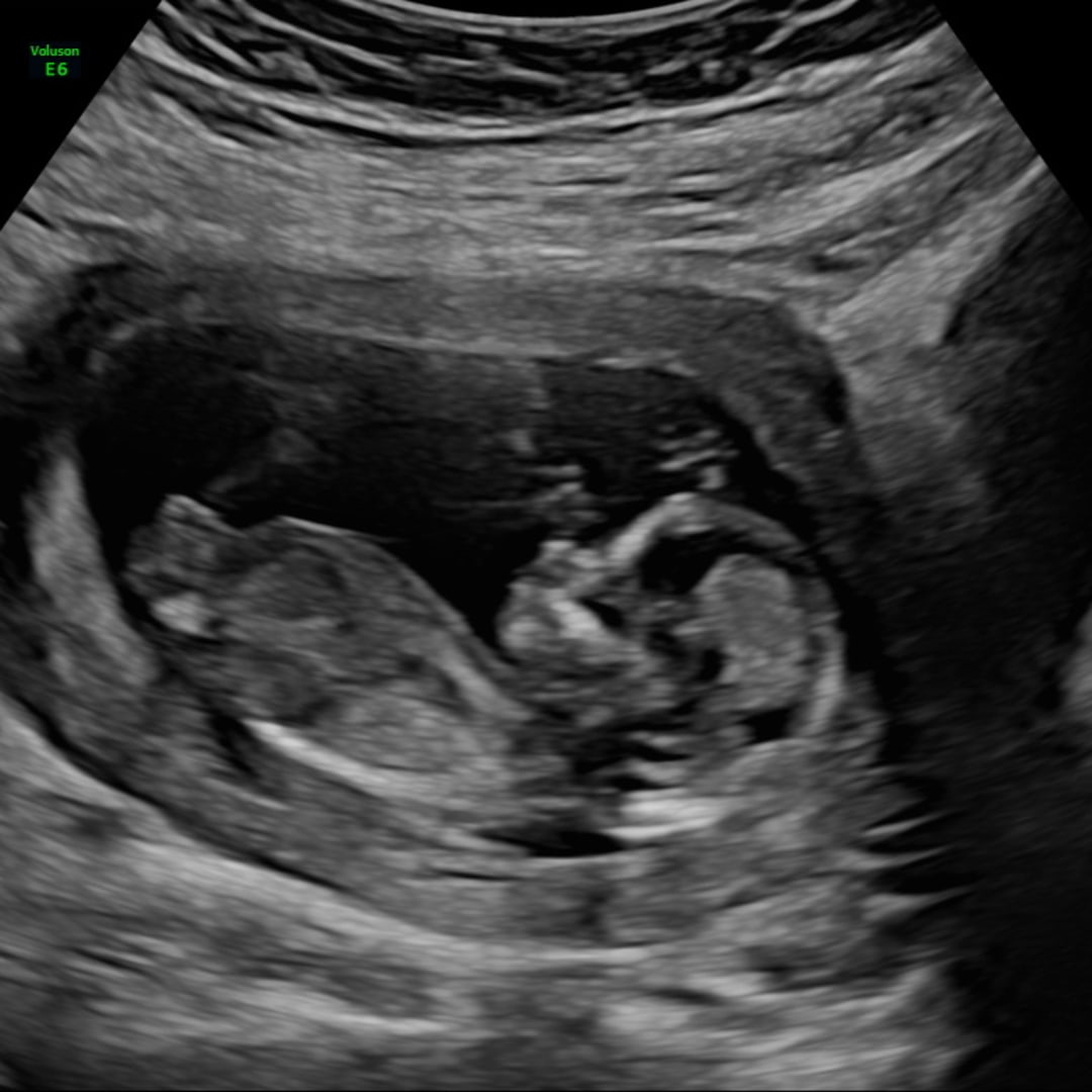 Photo shared by Wendy for their Babylist baby registry.