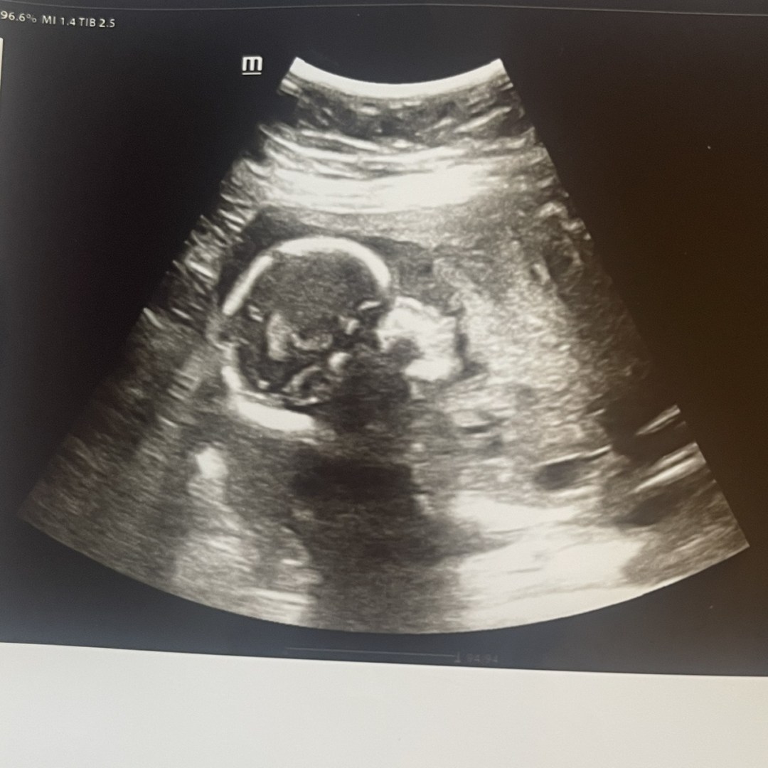 Photo shared by Harley for their Babylist baby registry.