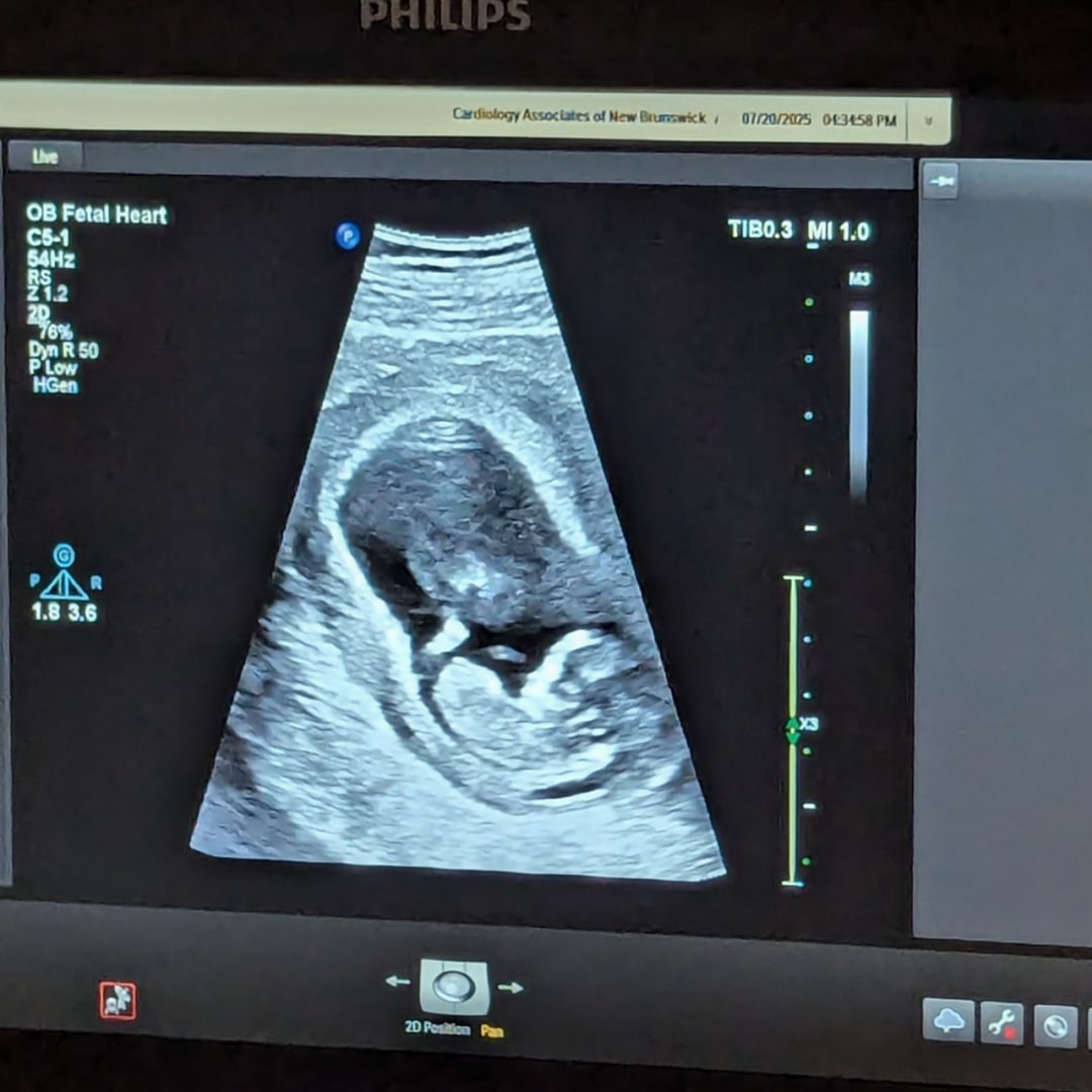Photo shared by Danielle for their Babylist baby registry.