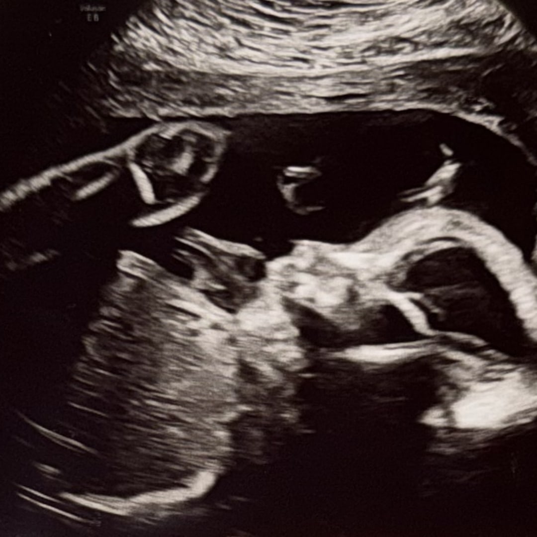 Photo shared by Kenley for their Babylist baby registry.