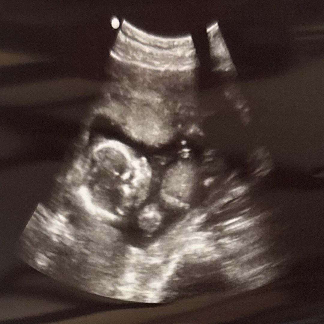 Photo shared by Hana-Kate for their Babylist baby registry.