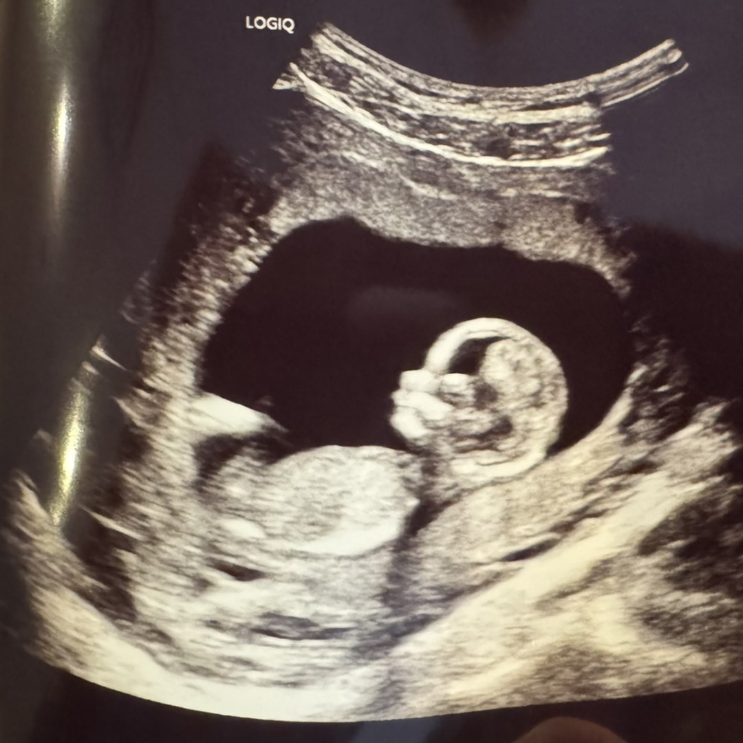 Photo shared by Janessa for their Babylist baby registry.