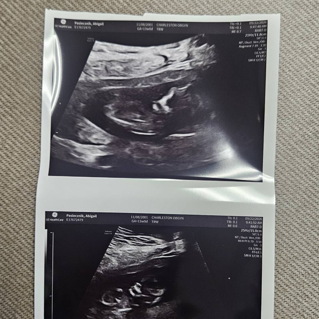 Photo shared by Abigail for their Babylist baby registry.