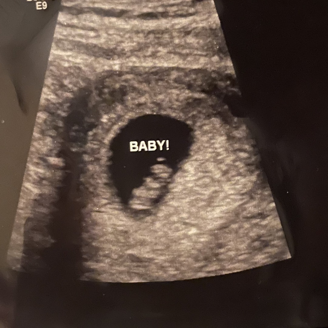 Photo shared by Amanda for their Babylist baby registry.