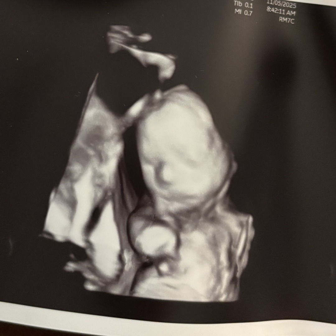 Photo shared by Jaiden for their Babylist baby registry.