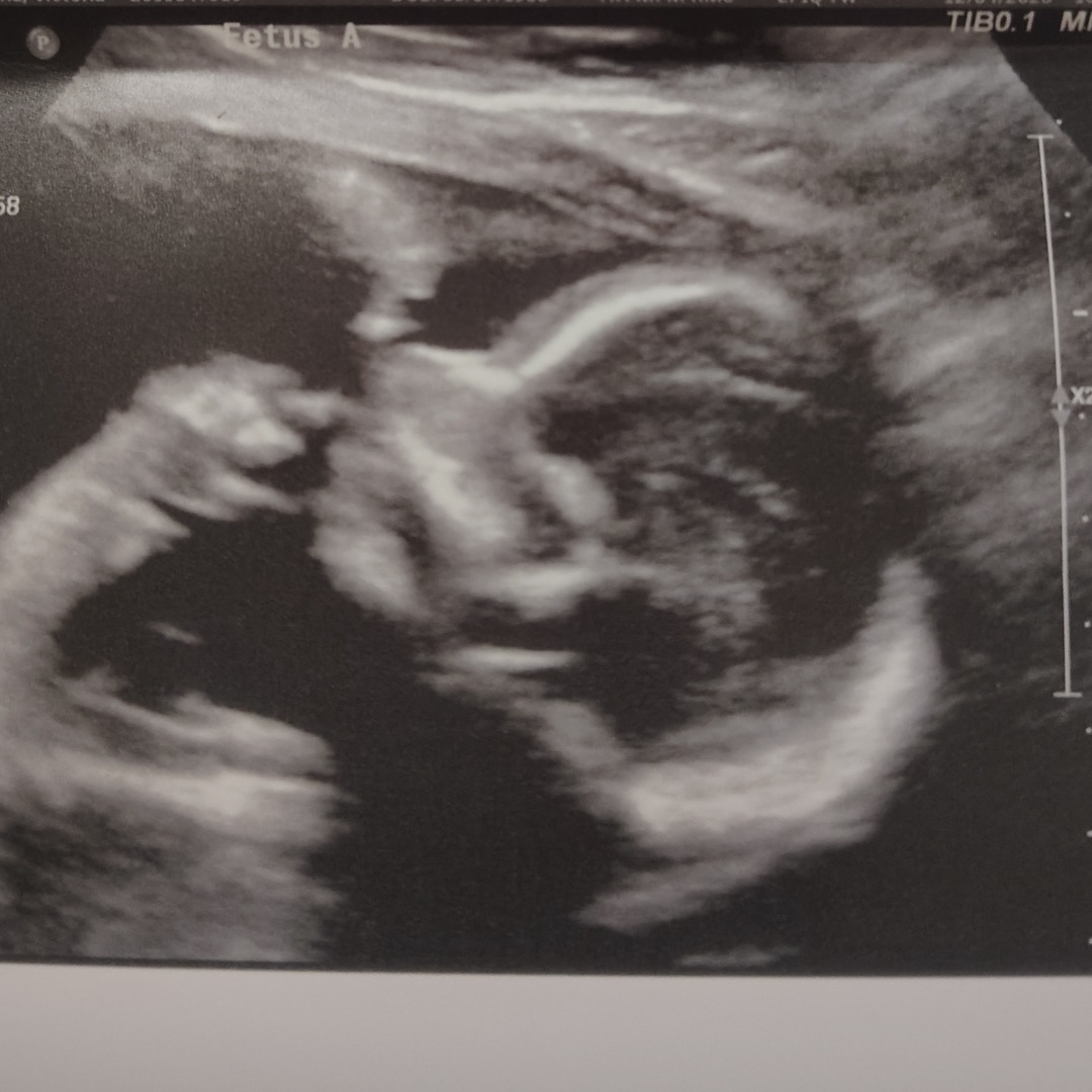 Photo shared by Victoria for their Babylist baby registry.