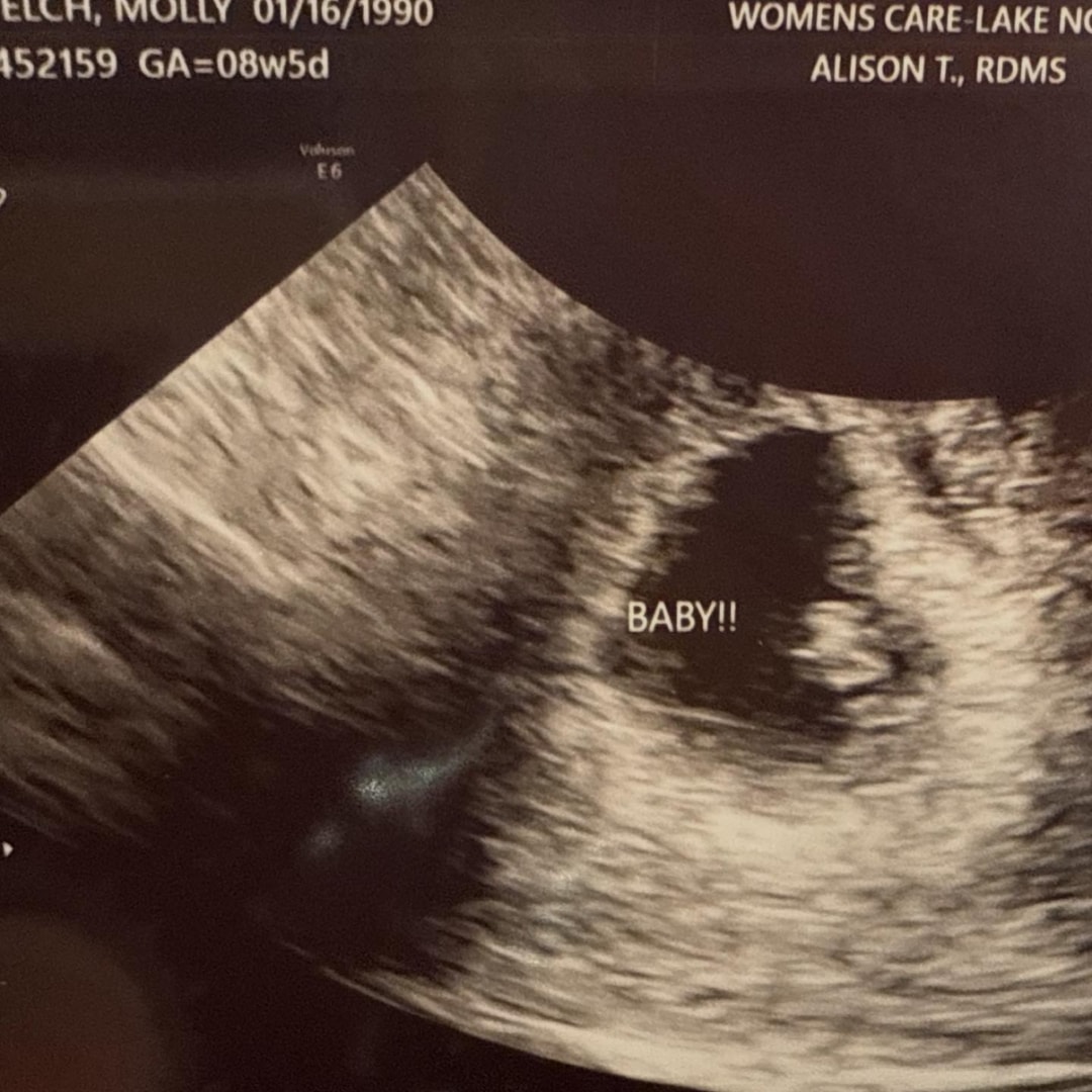 Photo shared by Molly for their Babylist baby registry.