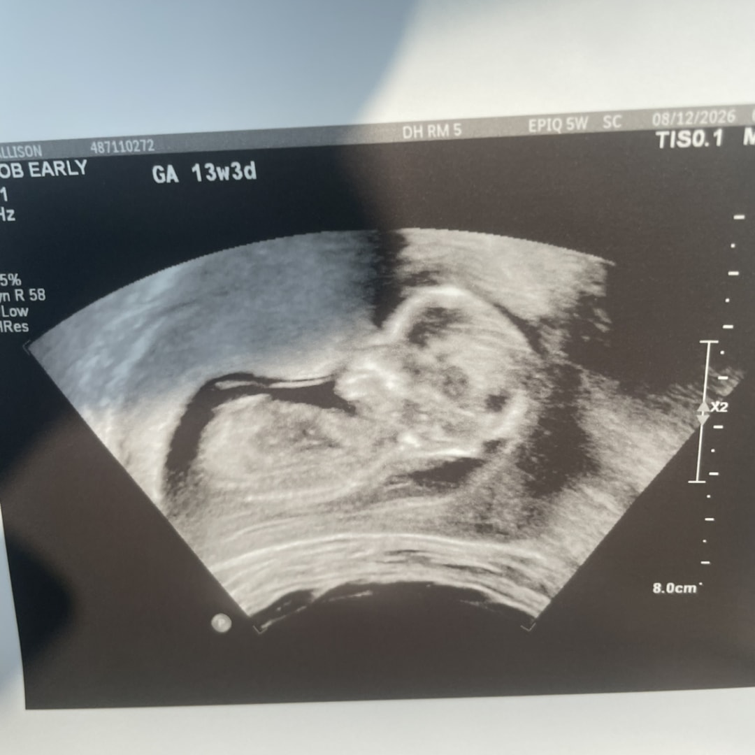 Photo shared by Alli for their Babylist baby registry.