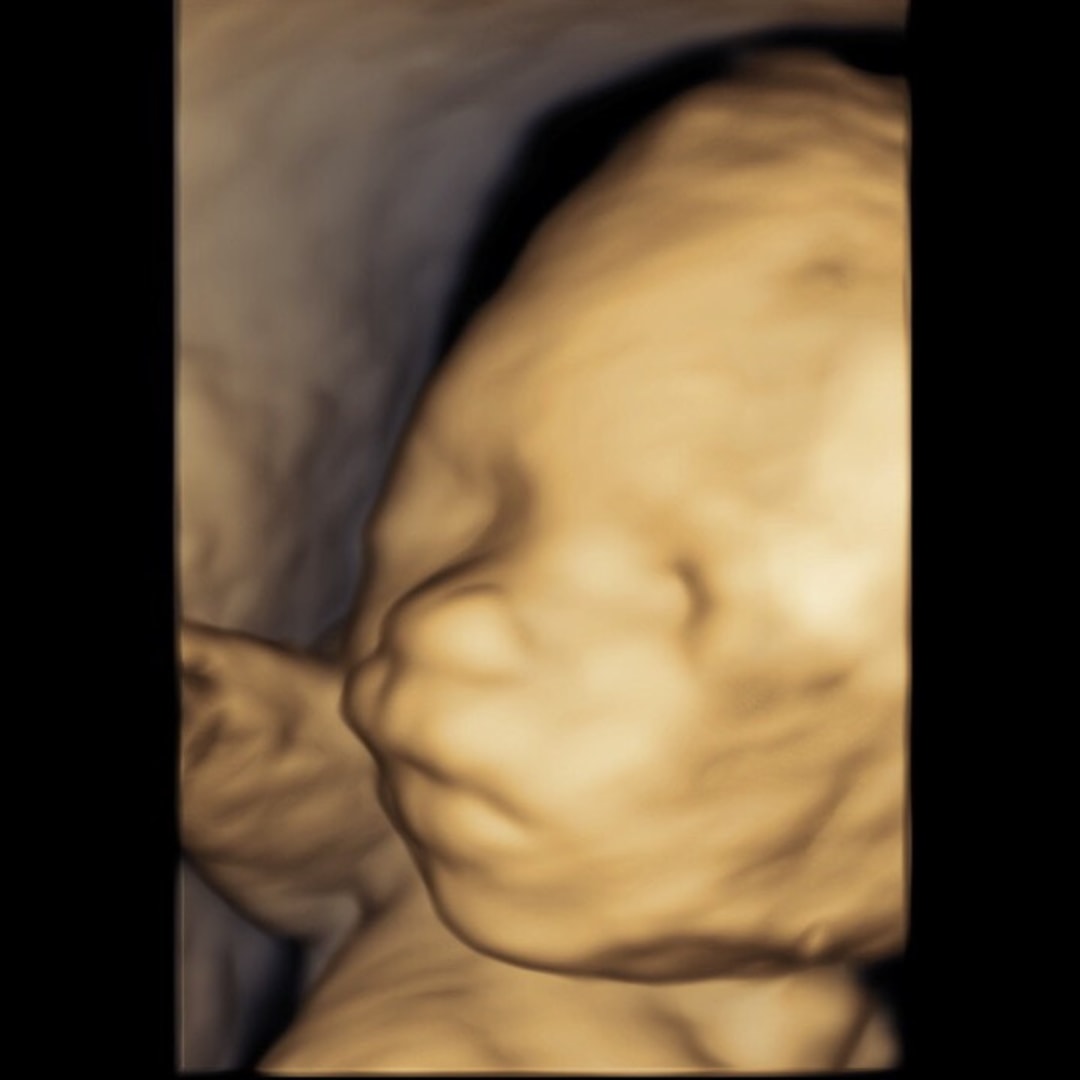 Photo shared by Chrissy for their Babylist baby registry.