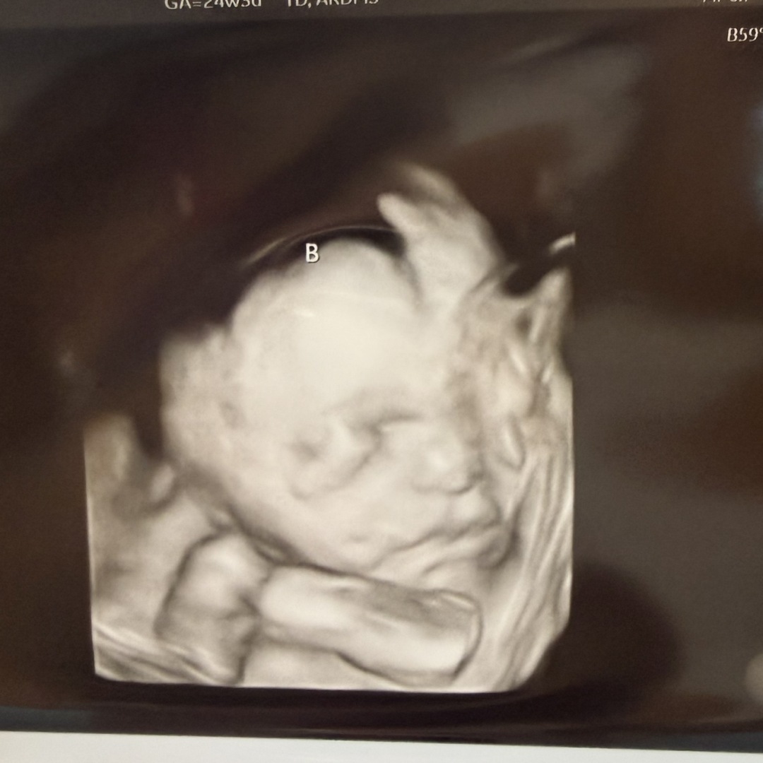 Photo shared by Alexis for their Babylist baby registry.