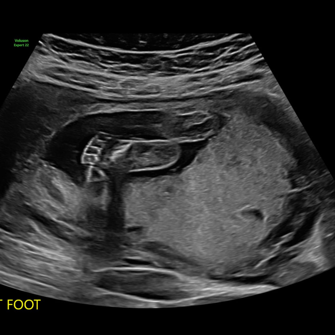 Photo shared by Isabella for their Babylist baby registry.