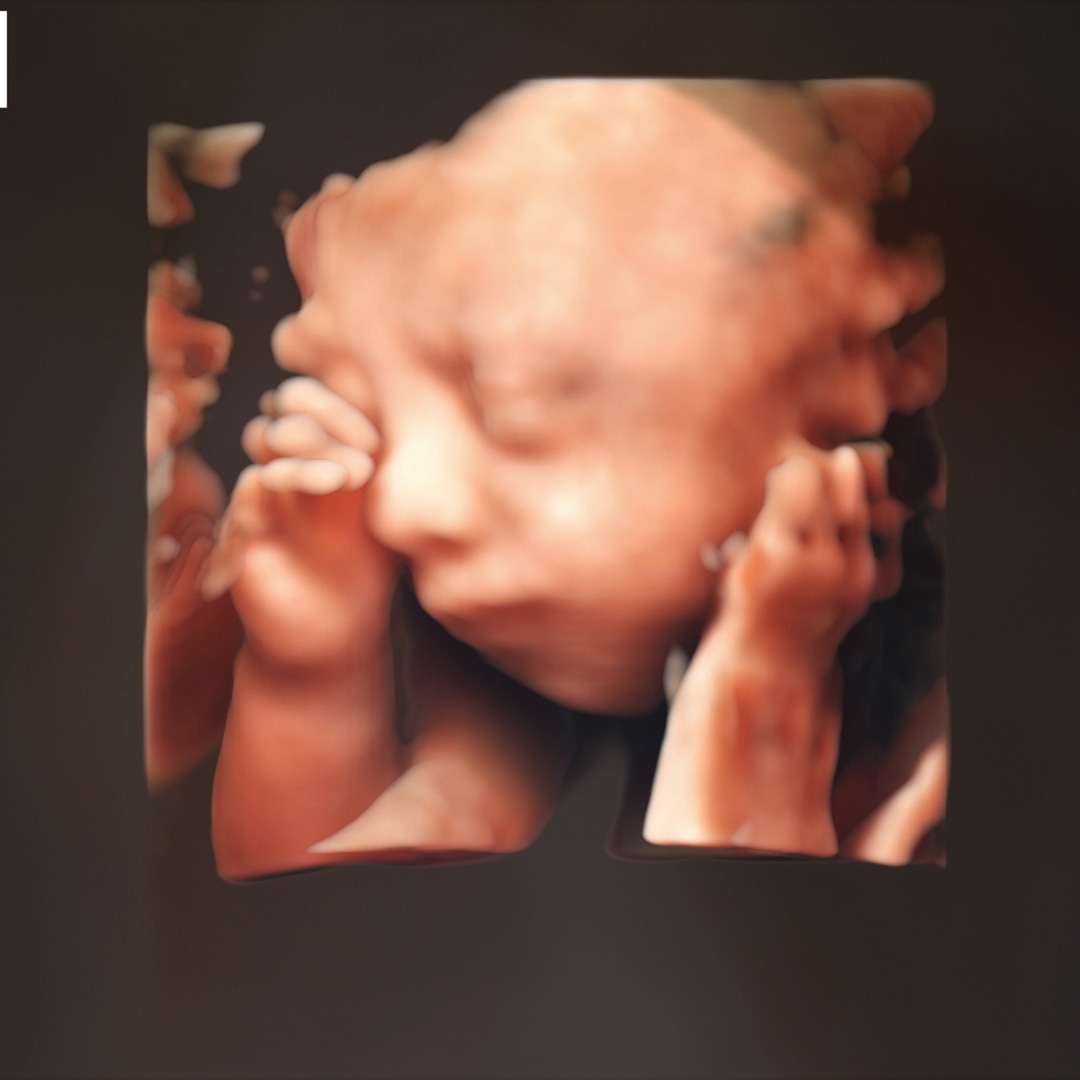 Photo shared by Georgia for their Babylist baby registry.