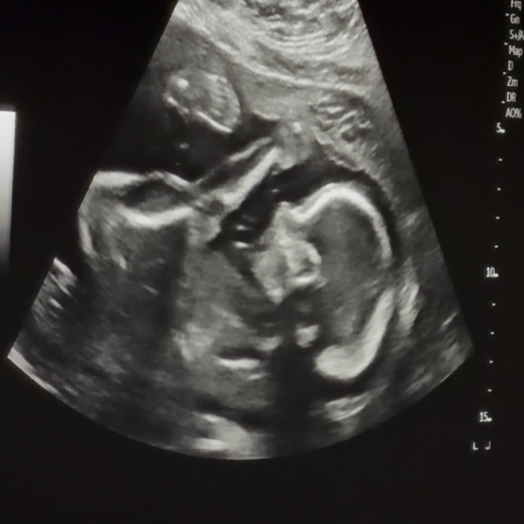 Photo shared by Grace for their Babylist baby registry.