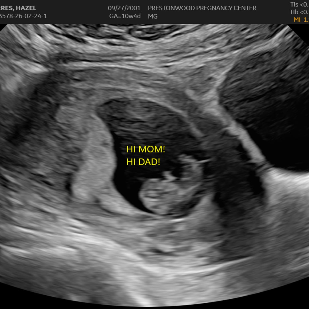 Photo shared by Hazel for their Babylist baby registry.