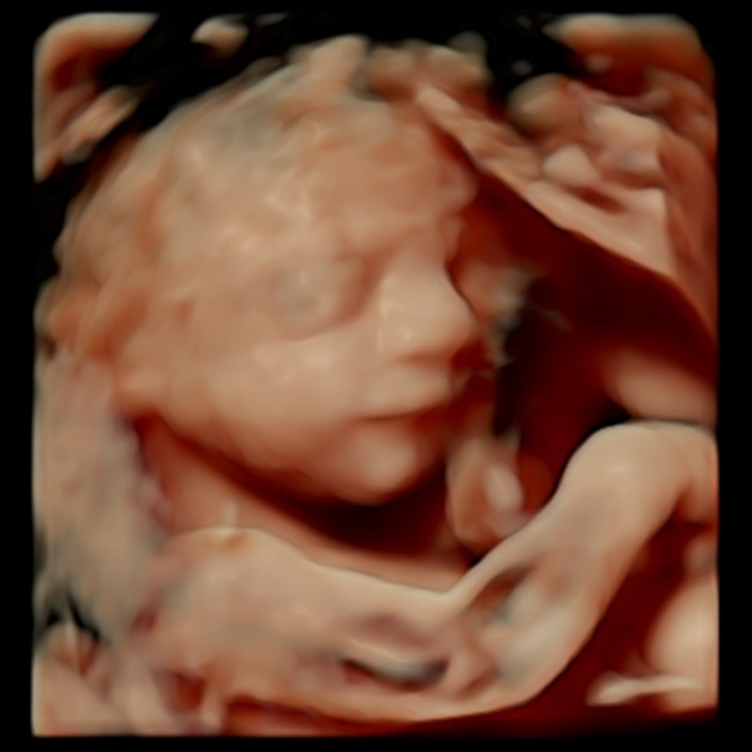 Photo shared by Ashlyn for their Babylist baby registry.