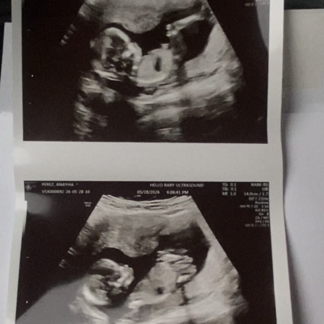 Photo shared by Anayha for their Babylist baby registry.