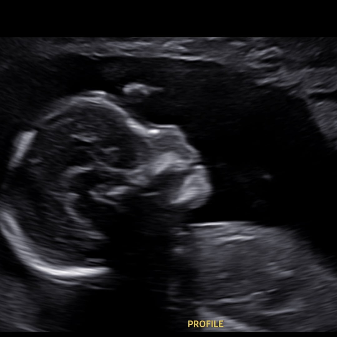 Photo shared by Cat for their Babylist baby registry.