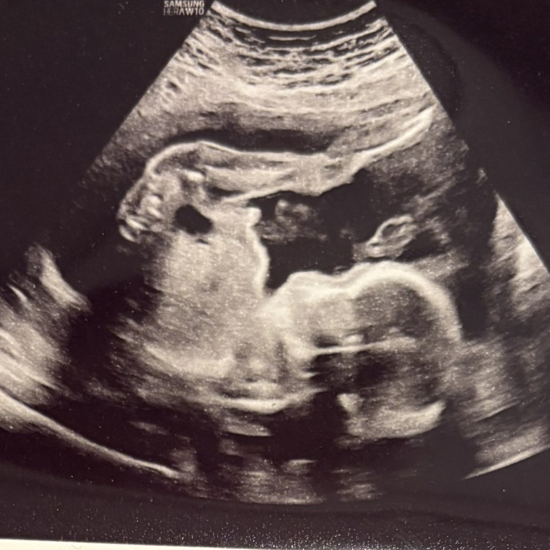 Photo shared by Brittany for their Babylist baby registry.