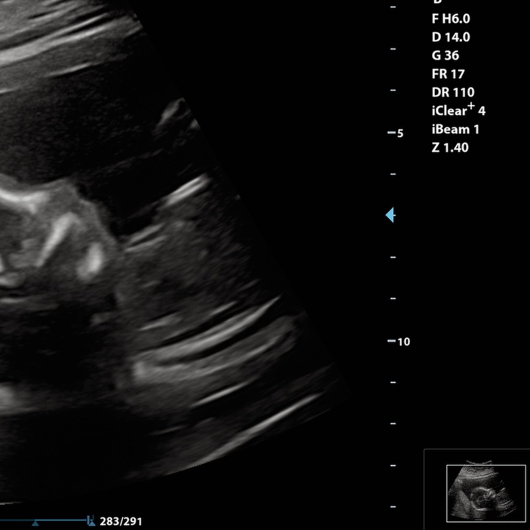 Photo shared by Emily for their Babylist baby registry.