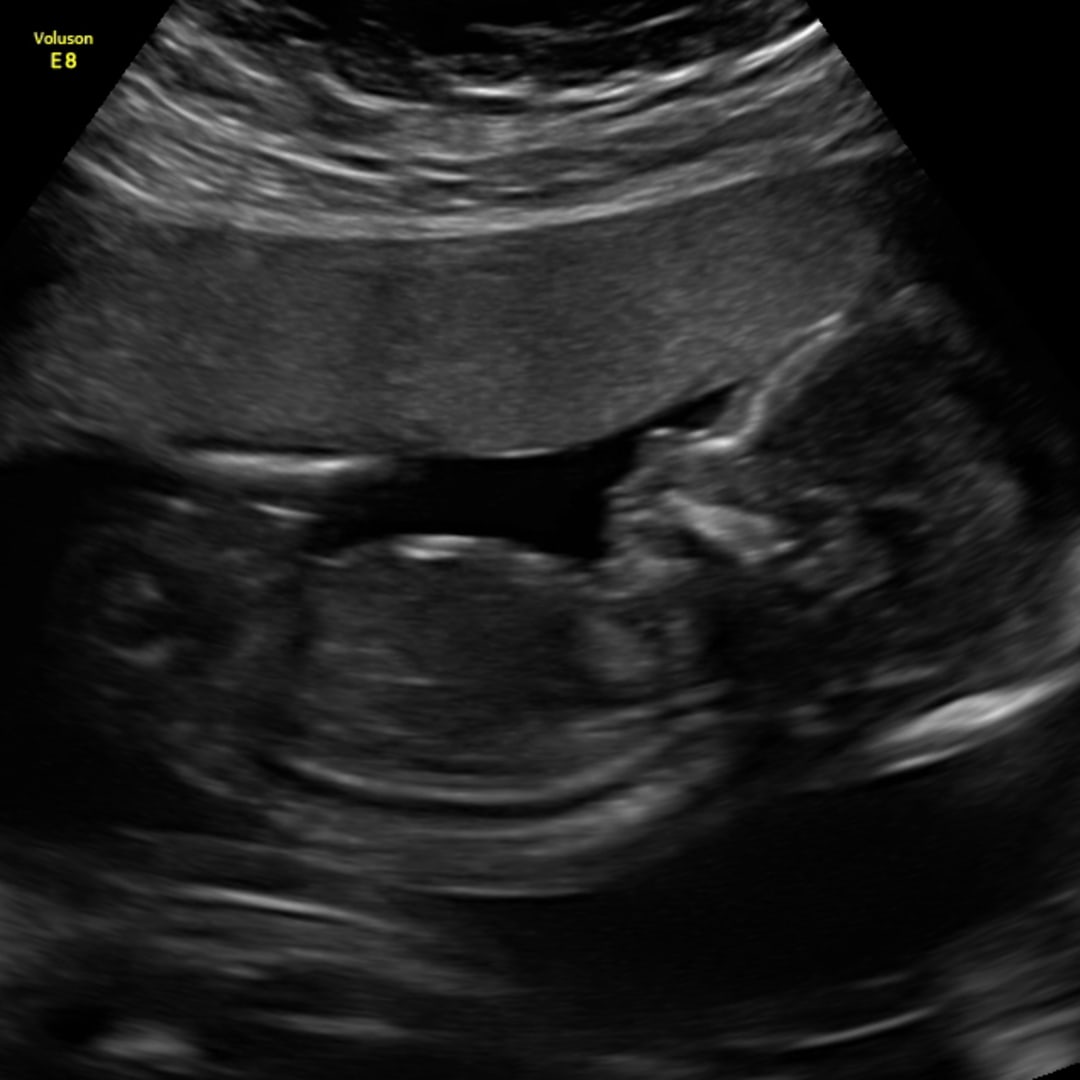 Photo shared by Amanda for their Babylist baby registry.