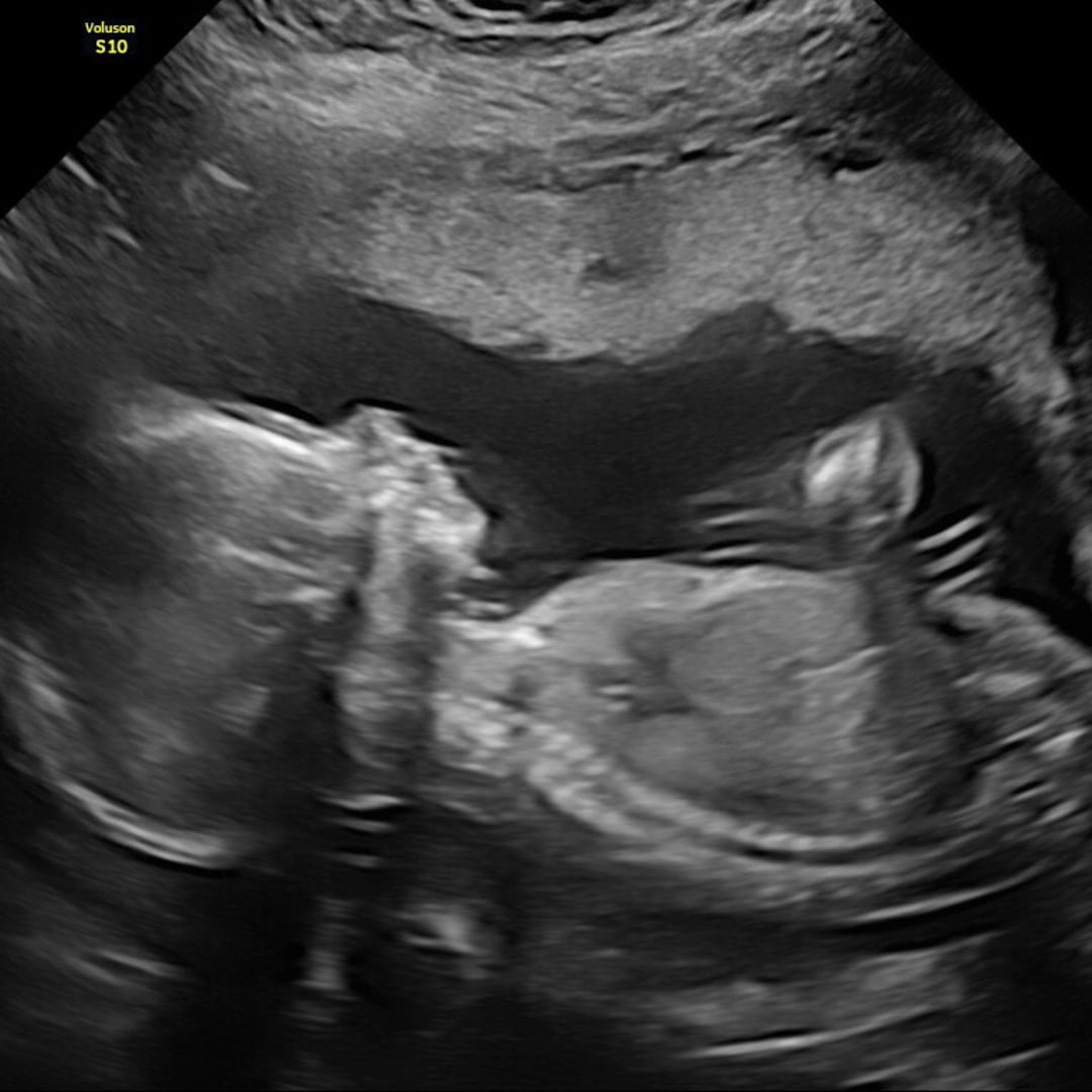 Photo shared by Brigitte for their Babylist baby registry.