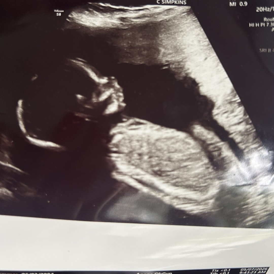 Photo shared by Summer for their Babylist baby registry.
