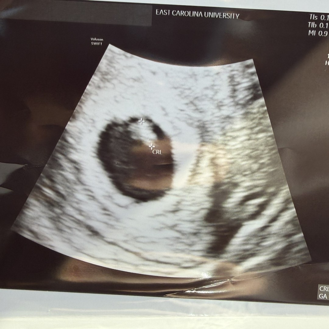 Photo shared by Shannon for their Babylist baby registry.