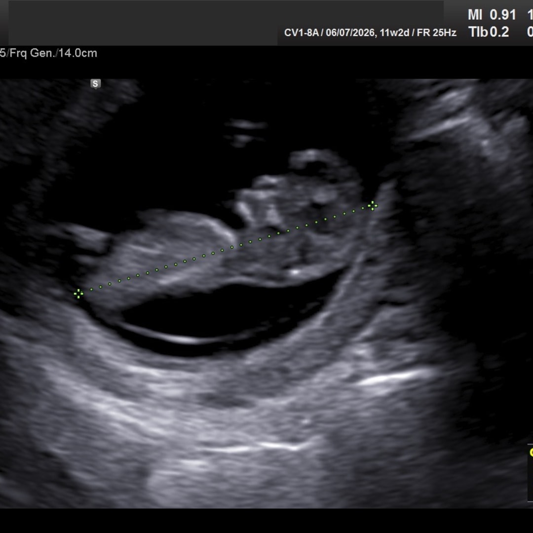 Photo shared by Ashlie for their Babylist baby registry.