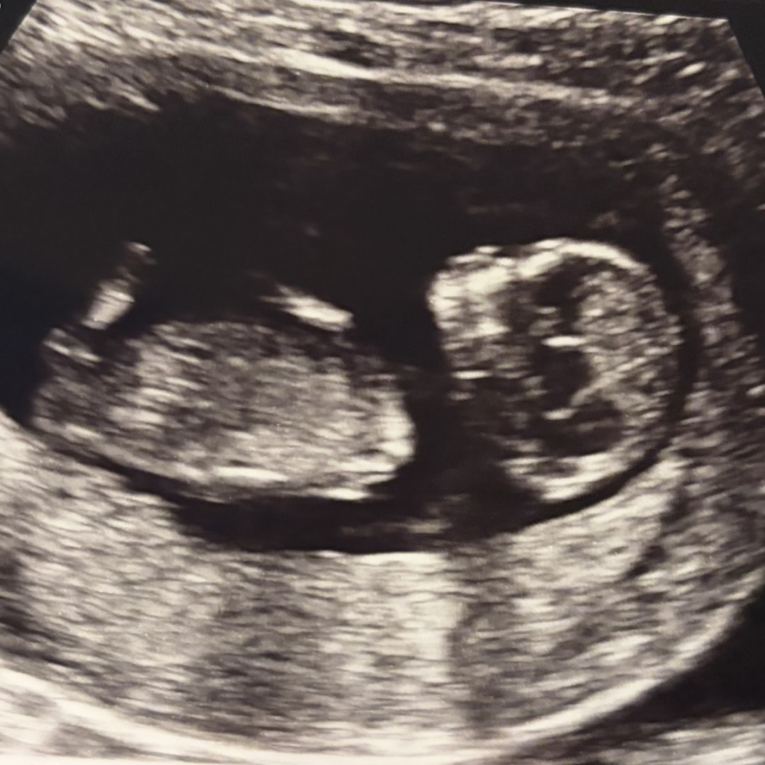 Photo shared by Molly for their Babylist baby registry.
