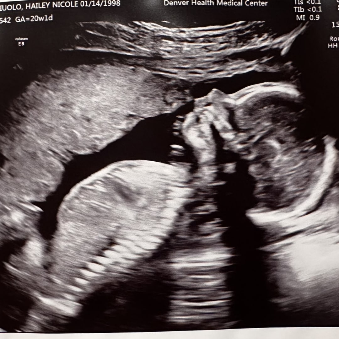 Photo shared by Hailey for their Babylist baby registry.