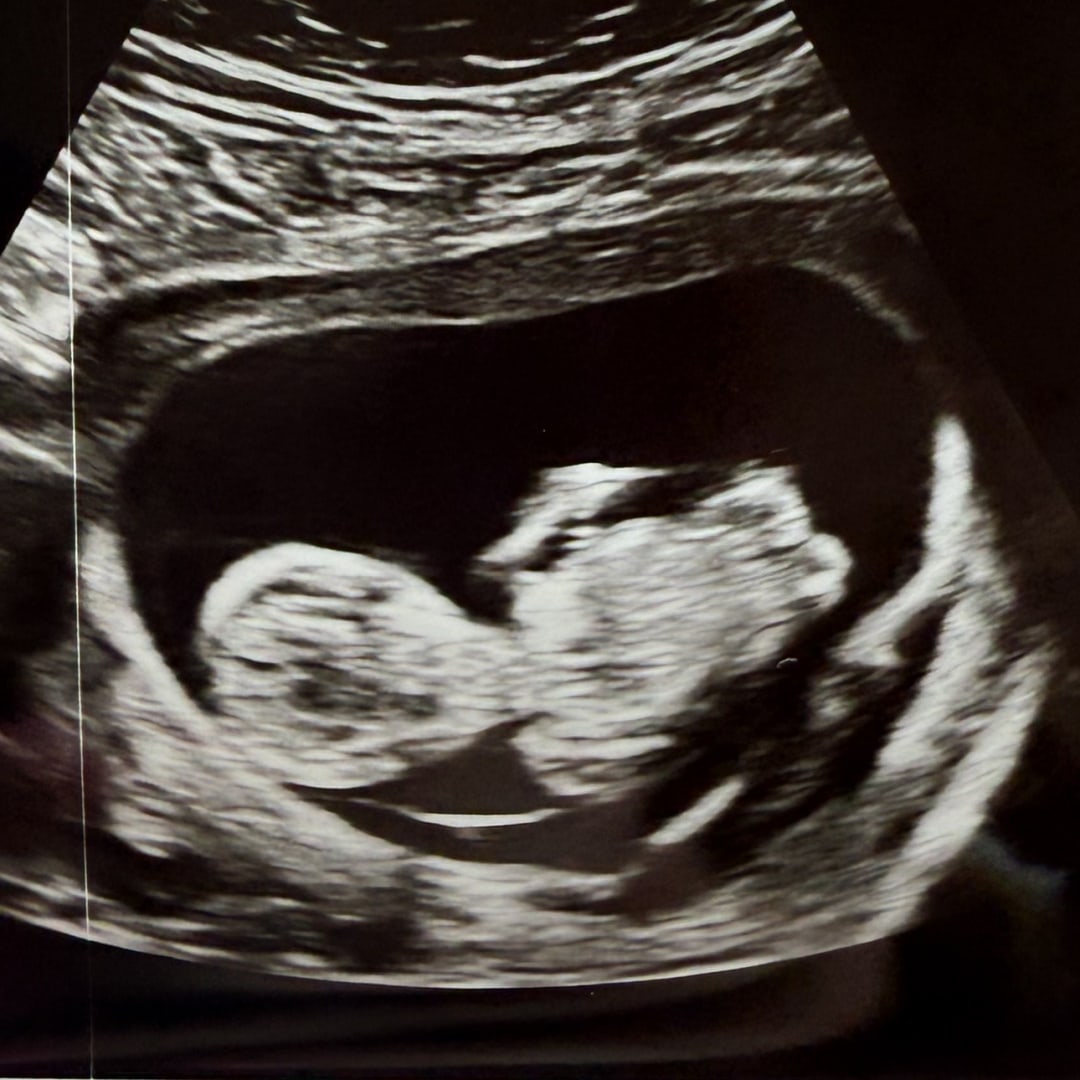 Photo shared by Bryce for their Babylist baby registry.