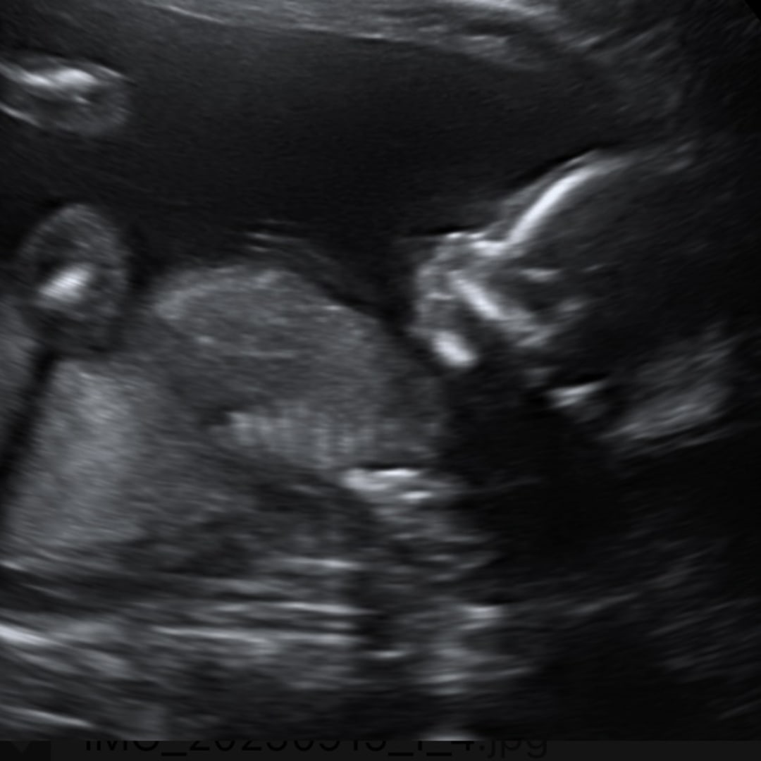 Photo shared by Emalee for their Babylist baby registry.